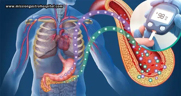 Diabetes & Gut Health: How Your Microbiome Controls Blood Sugar