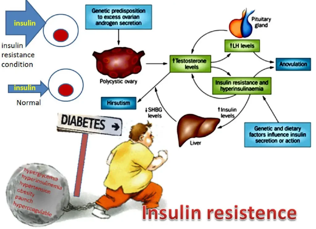 7-Day Insulin Resistance Meal Plan